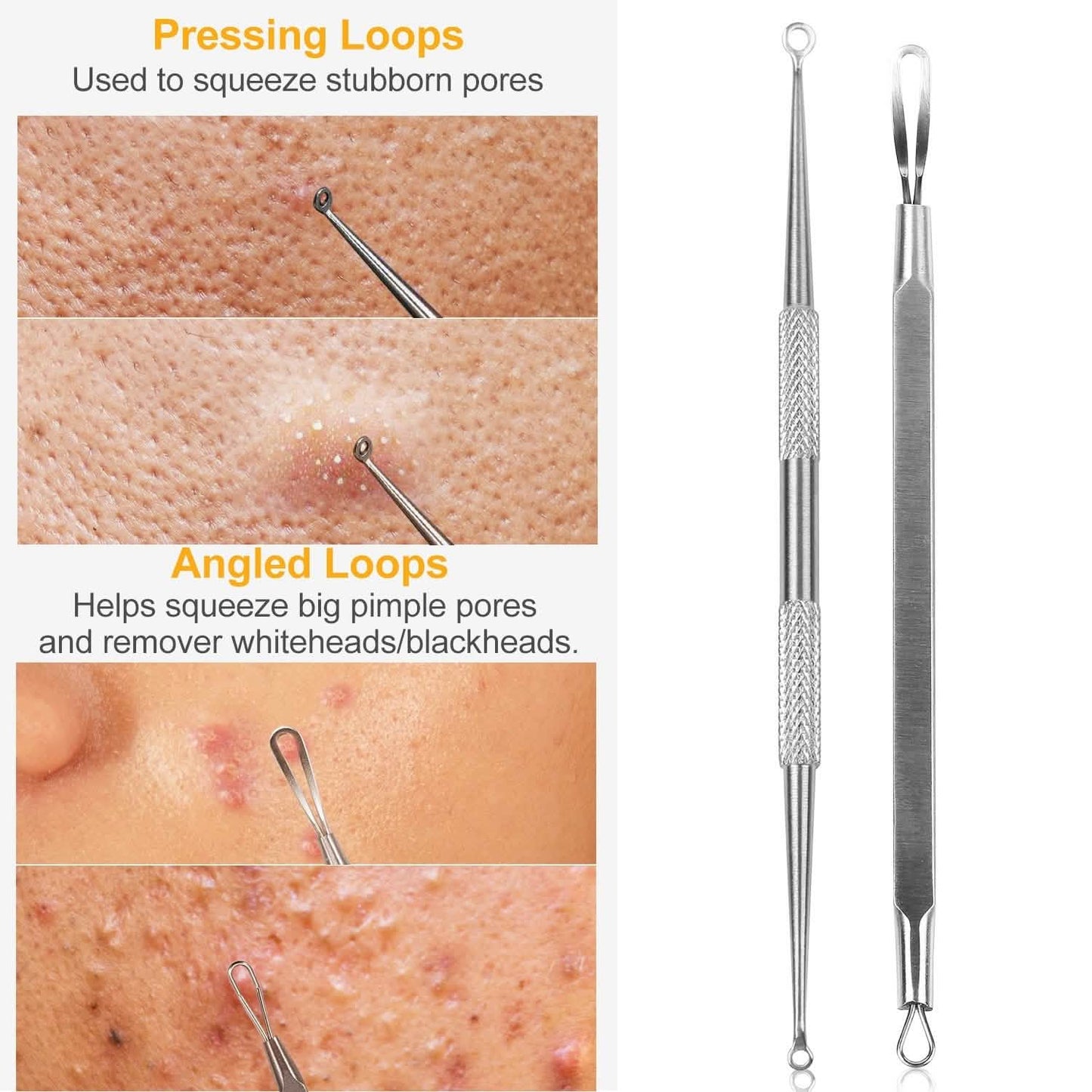 5-Piece Set: Blackhead Remover Kit Stainless Steel