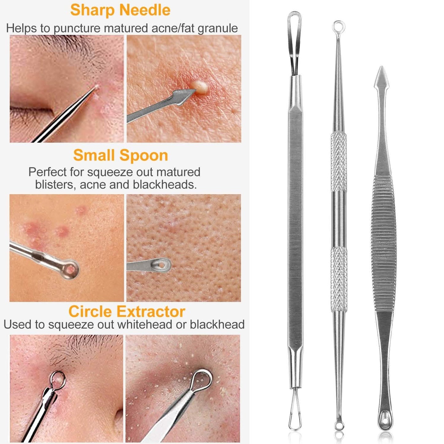 5-Piece Set: Blackhead Remover Kit Stainless Steel