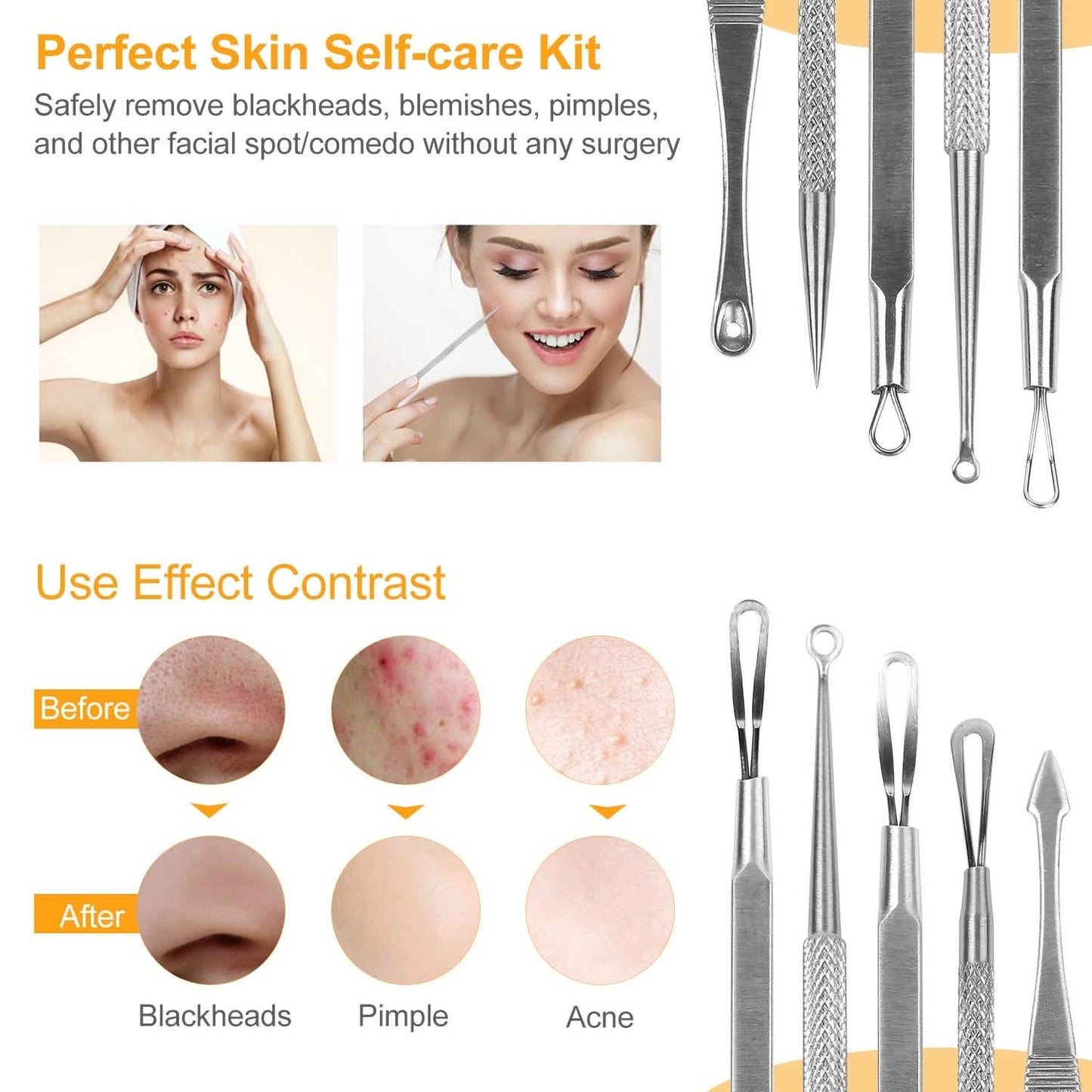 5-Piece Set: Blackhead Remover Kit Stainless Steel